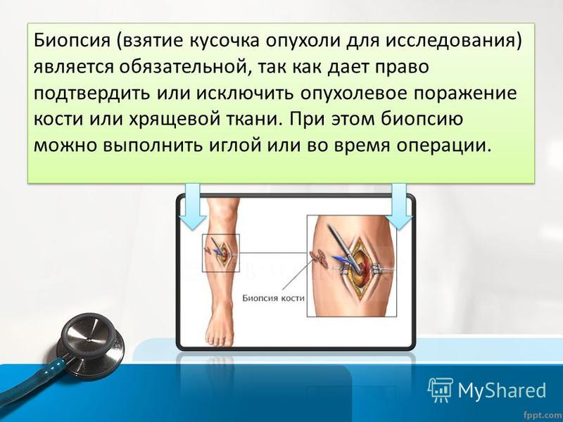 Взятие биоптата. Биопсия новообразования. Открытая биопсия кости.