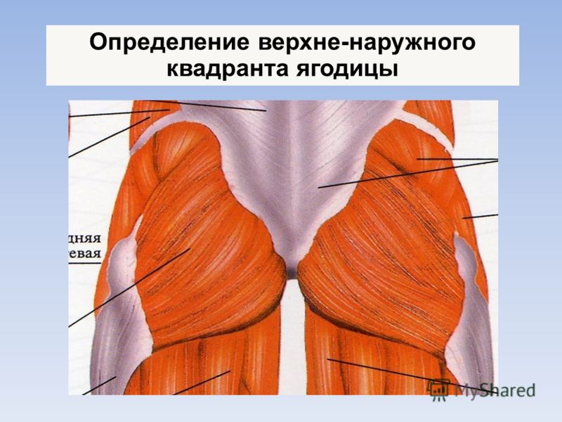 Мышцы ягодицы анатомия картинки для уколов