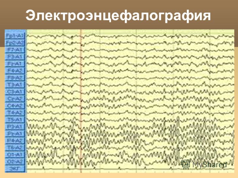 Ээг картинка для презентации