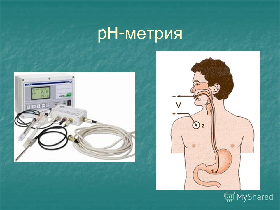 Кислотность пищевода. Измерение кислотности желудка PH-метрия. РH метрия желудочного сока. РН метрия пищевода зонд. Внутрижелудочная PH-метрия норма.