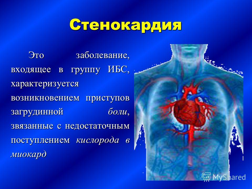 Больному стенокардией. Болезнь сердца стенокардия. Стенокардия это заболевание. Стенокардия презентация.