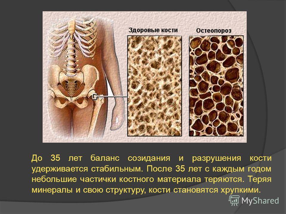 Центр остеопороза