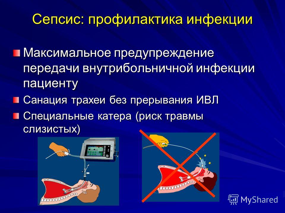 Профилактика м. Профилактика при сепсисе. Мероприятие по профилактике сепсиса.