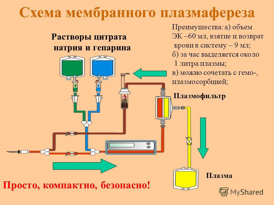 Очищение Крови Плазмаферез Показания Цена