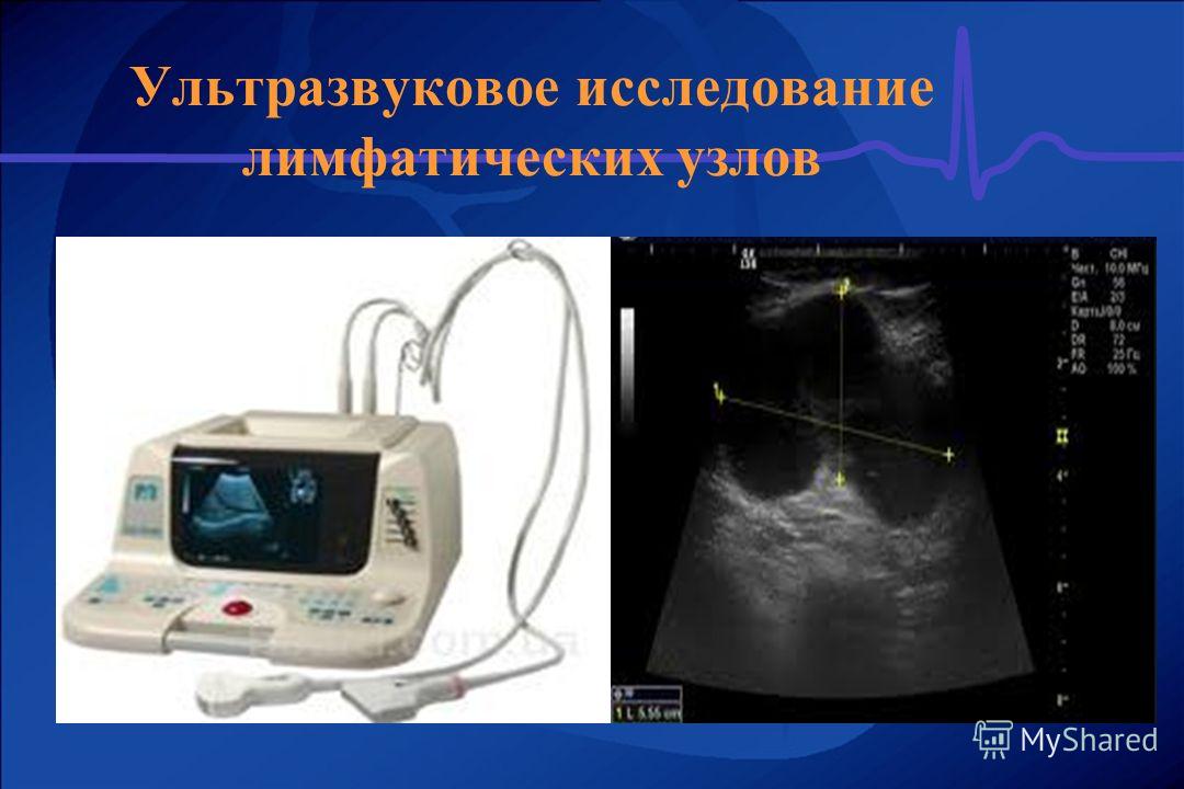 Узи узлов. УЗИ лимфатических узлов. УЗИ лимфатической системы. Подготовка к УЗИ лимфатических узлов.