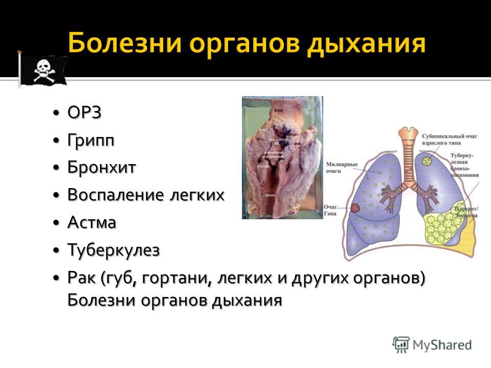 Легкий доклад. Болезни органов дыхательной системы. Заболевания дыхательной системы кратко. Болезни органов дыхания человека и их профилактика. Заболевания органов дыхания кратко.