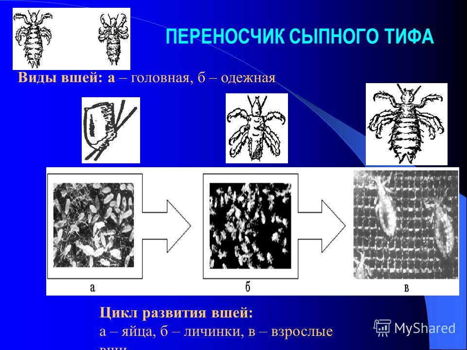 Сыпной тиф клиническая картина