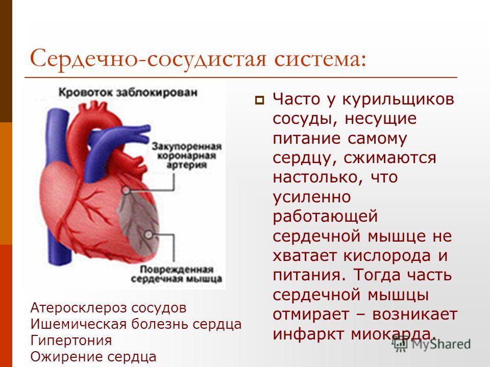 Болезни сердечной мышцы