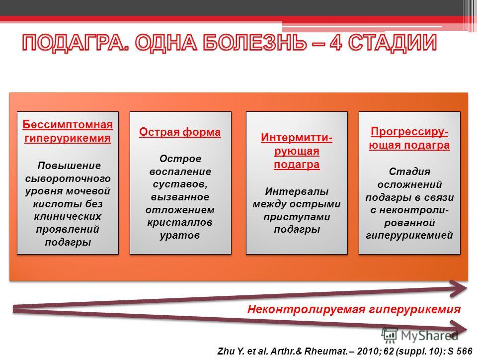 Гиперурикемия что это. Стадии развития подагры. Клинические формы подагры.