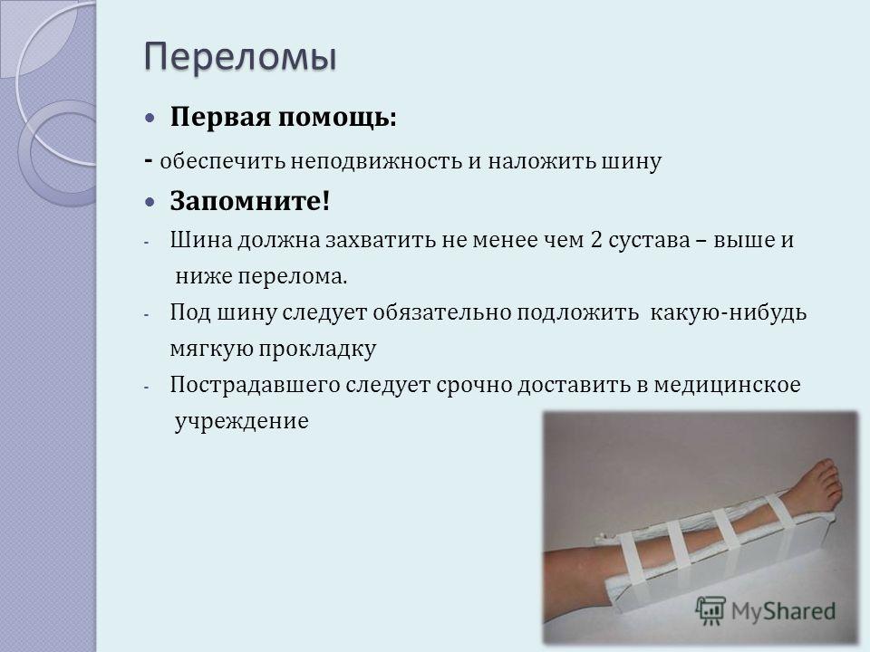 Можно ли при переломе. Виды переломов и первая помощь. Виды переломов первая помощь при закрытых переломах.