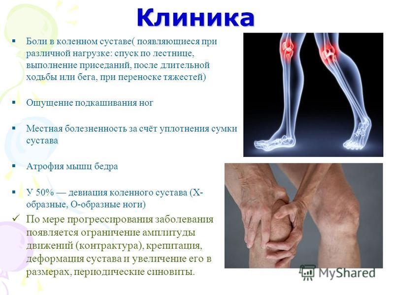 Боль и слабость в стопе. Болит коленка при ходьбе причины. Болезненность суставов. Болят суставы.