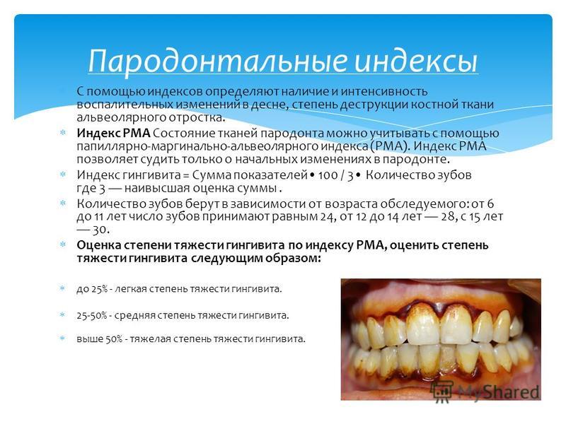 Стоматология пародонтальная карта