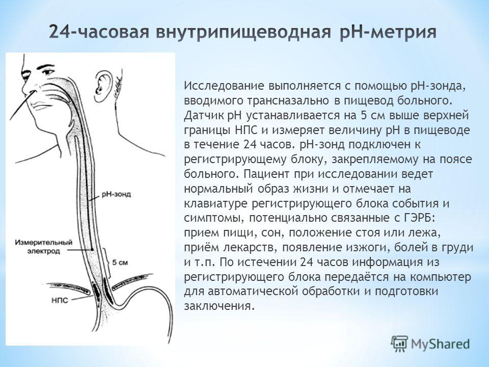 Пищевод кроссворд