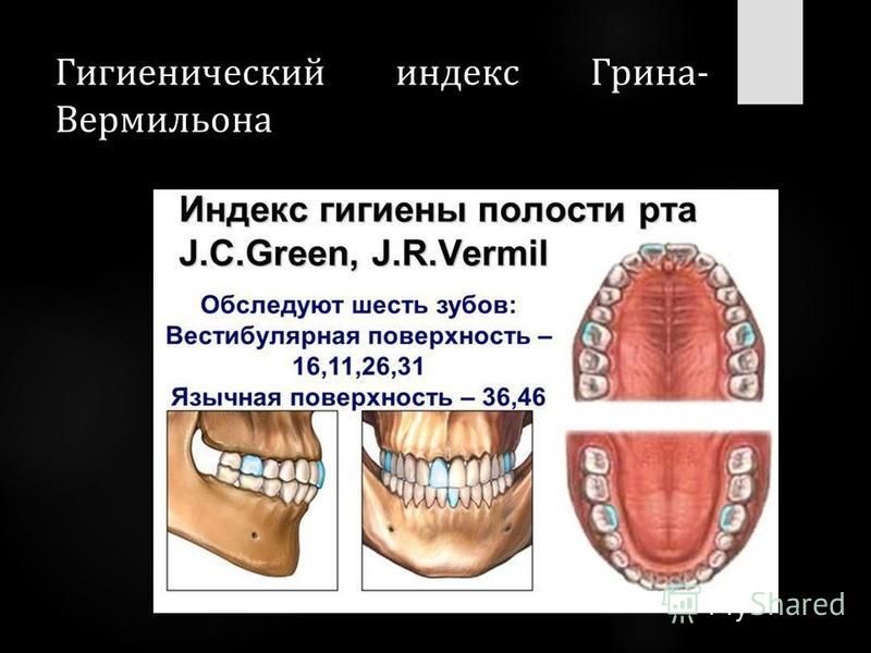 Индекс гигиенического состояния полости рта. Гигиенический индекс Грина-Вермильона. Индекс Грина Вермиллиона зубы. Игру Грина Вермильона. Индекс гигиены полости рта.