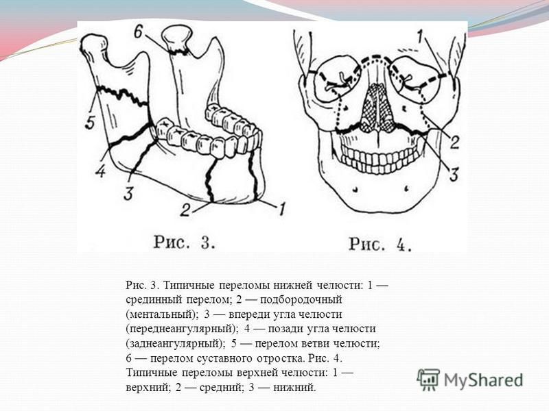 Карта вызова травма уха