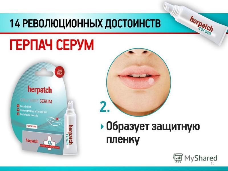 Эффективное лечение герпеса на губах препараты