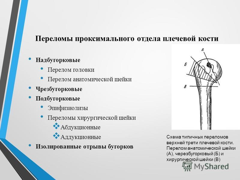 Средняя треть плечевой кости. Перелом плечевой кости классификация рентген. Перелом эпифиза плечевой кости классификации. Классификация переломов головки плечевой кости.