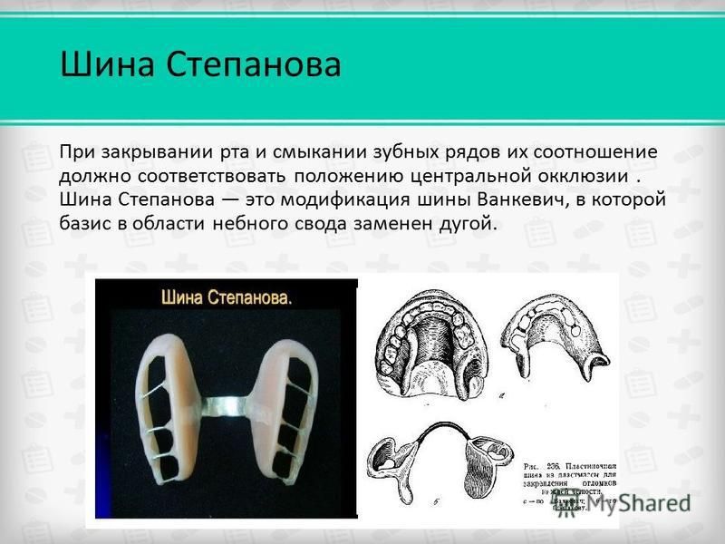 Шина Ванкевича и Померанцевой-Урбанской.