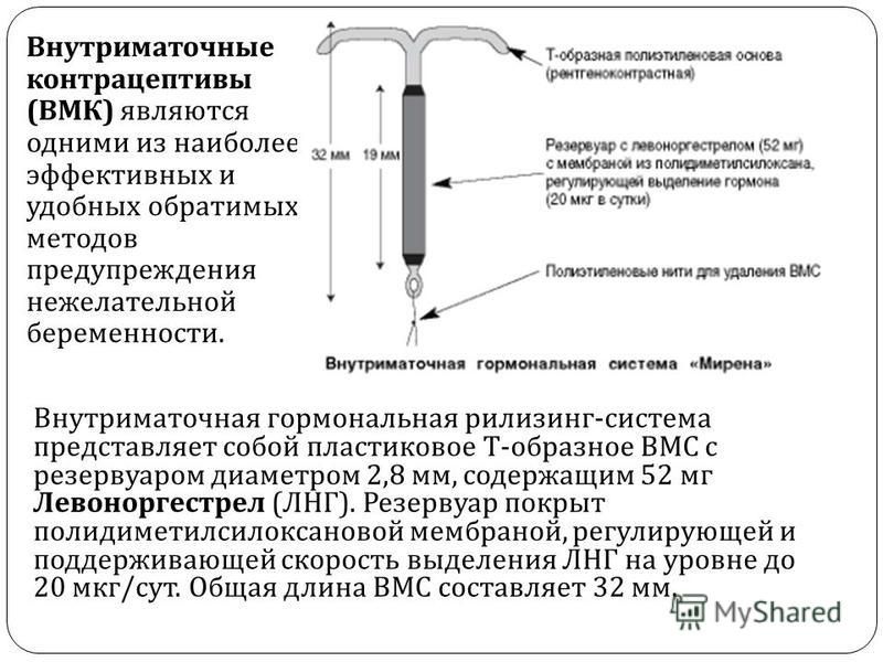 После удаления мирены