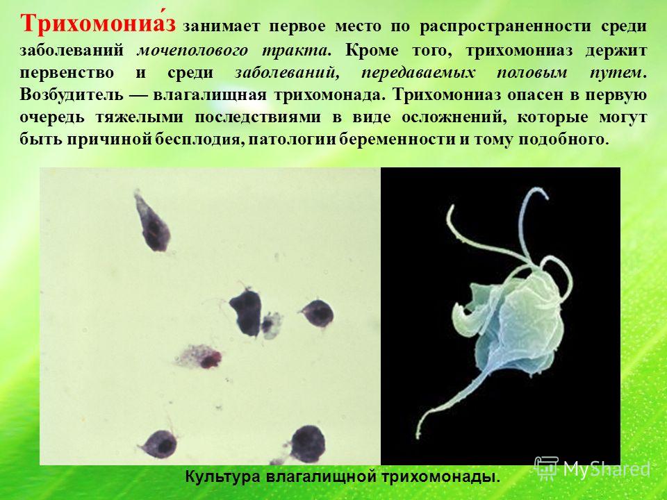 Микоплазма трихомонада. Влагалищная трихомонада. Трихомонада возбудитель.