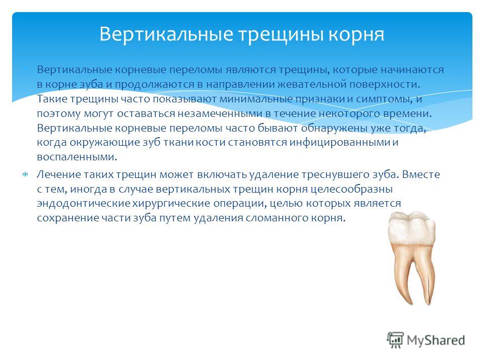К чему снится корень зуба. Трещины на зубах вертикальные. Вертикальный перелом зуба. Микротрещина в корне зуба.