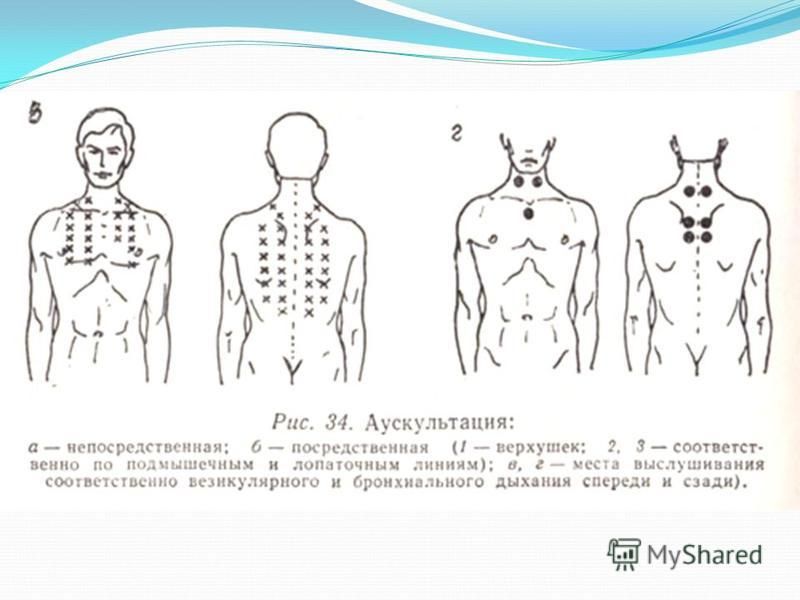 Аускультация легких картинки