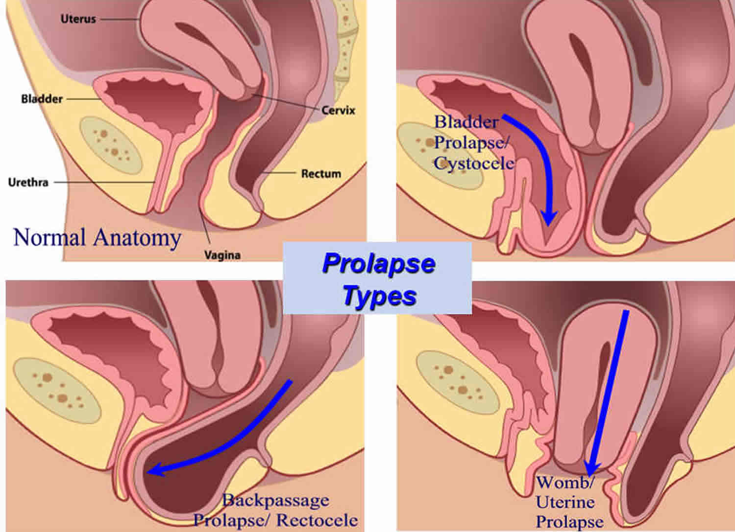 Types Of Pussys