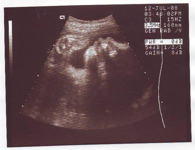 Узи 34 недели беременности. Ущи девочки на 34неделе. Фото УЗИ 34 недели беременности.