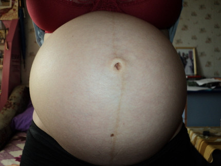Беременность 36 недель каменеет. Живот на 36 неделе беременности. Живот на 35 36 неделе беременности. Живот беременной 36 недель. 36 Недель каменеет живот.