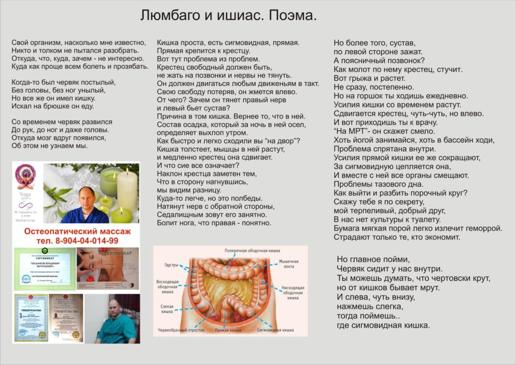 Люмбаго с ишиасом поясничного отдела. Люмбаго. Люмбаго симптомы. Люмбаго с ишиасом симптомы и лечение. Лекарство от люмбаго с ишиасом.