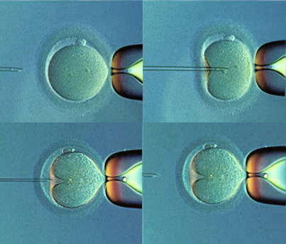 После неудачного эко. Этапы ИКСИ. Эмбрион ИКСИ. Метод ИКСИ. Эко ИКСИ стадии развития эмбриона.