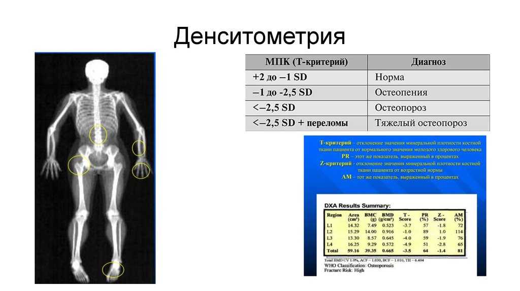 Денситометрия тазобедренных суставов и поясничного отдела позвоночника