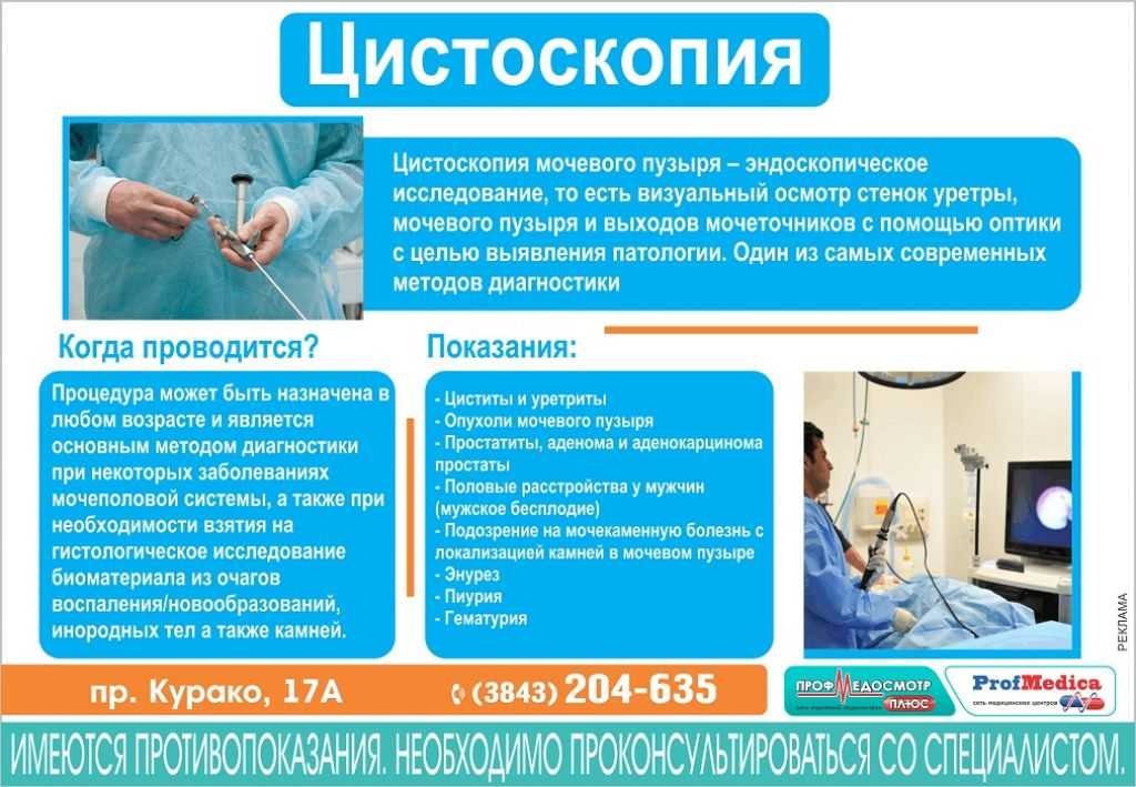 Подготовка к осмотру. Эндоскопическое исследование мочевого пузыря. Подготовка пациента к цистоскопии. Подготовка к эпистескопии. Подготовка к эндоскопическому исследованию мочевого пузыря.