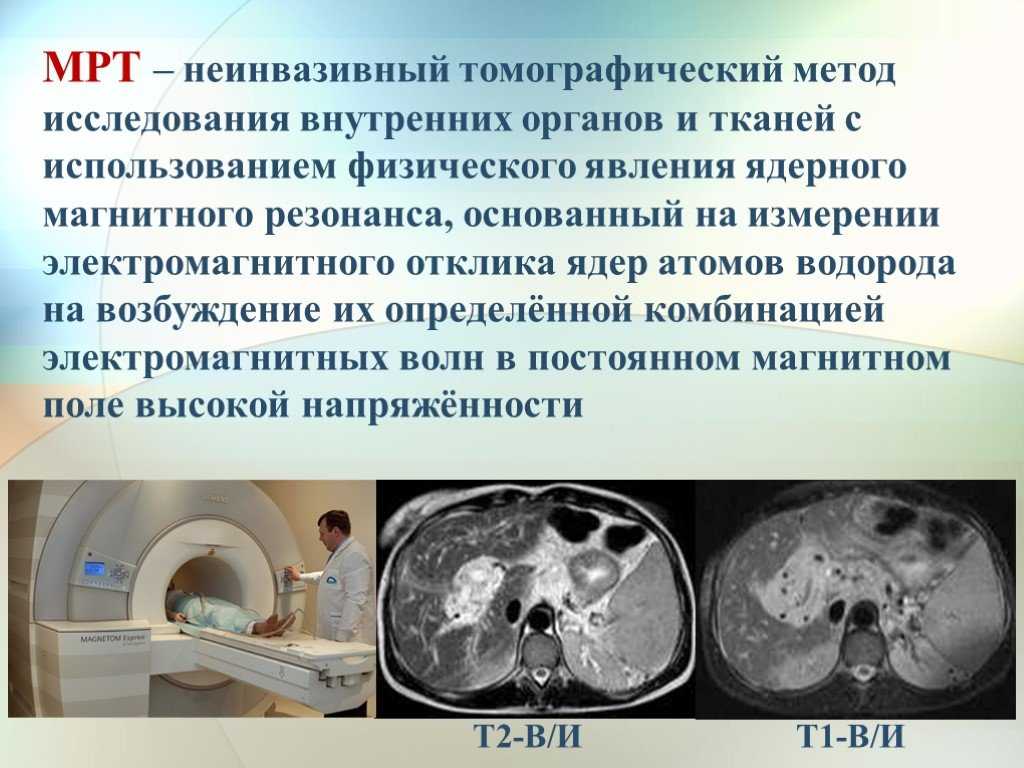Мрт печени презентация