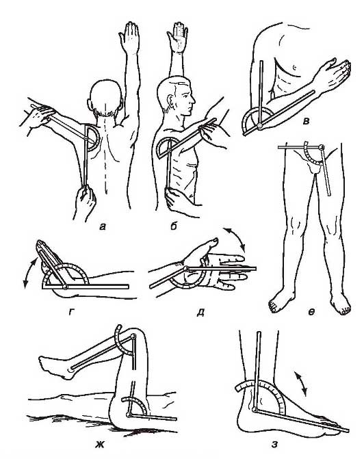 Сгибательная контрактура сустава. Переразгибание тазобедренного сустава. Сгибание разгибание тазобедренного сустава. Контрактура мышц коленного сустава. Разгибательная контрактура коленного сустава.