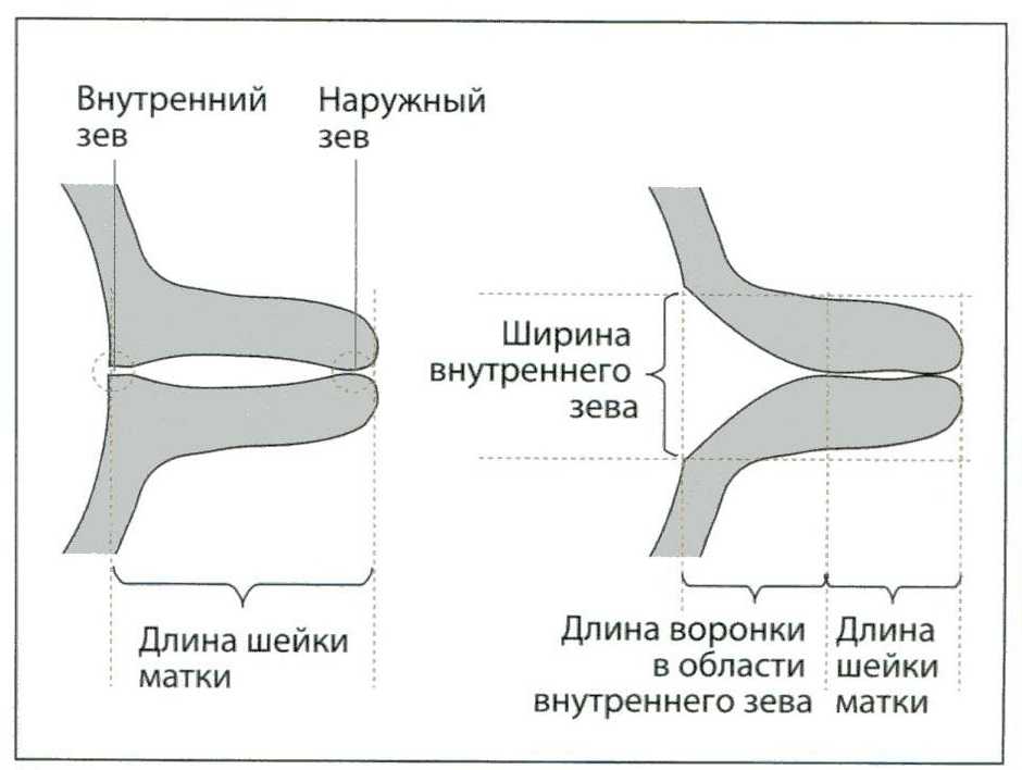 Длина шейки. Длина шейки матки измерение схема. Норма длины шейки матки при беременности по неделям. Шейка матки 37 мм при беременности. Шейка матки Размеры норма при беременности.