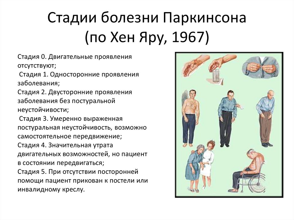 Стадии паркинсона. Болезнь Паркинсона 1-2 стадия по Хен-Яру. Болезнь Паркинсона акинетико-ригидная форма 3 стадия по Хен-Яру. Паркинсонизм шкала Хен Яра.