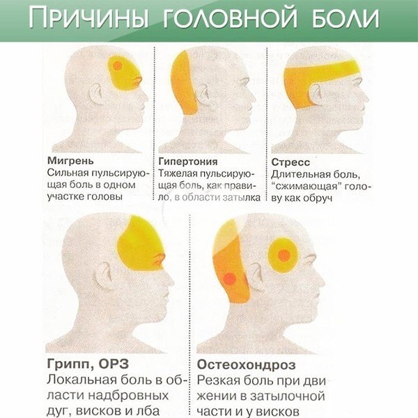 Давит затылок давление. Схема локализации головной боли. Причины головной боли.