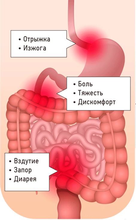 Боли кишечника где болит. Вздутие и дискомфорт в кишечнике. Спастическое сокращение кишечника.