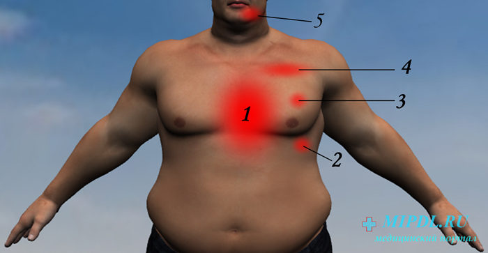 Болит левая сторона груд. Болит левая часть под грудью. Боль в солнечном сплетении сердце