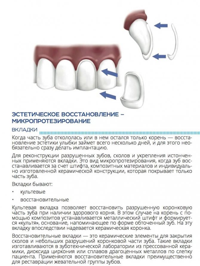 Протезирование зубов инвалиду 1 группы. Съемный микропротез 1 зуб. Виды зубных протезов восстанавливающих анатомическую форму зубов. Классификация несъемных протезов ортопедическая стоматология. Конструкция протеза зубов.