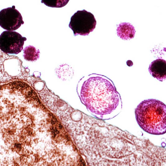 Chlamydia trachomatis mycoplasma genitalium. Хламидиоз под микроскопом. Хламидий микробиология.