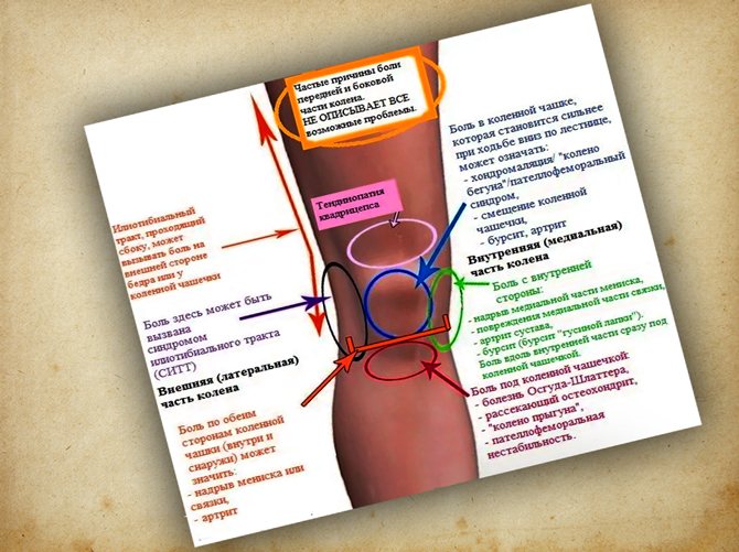 Болят колени причина при сгибании. Боль кв колени при ходьбе. Болит колено при ходьбе. Болит колено с внутренней стороны. Болит колено при сгибании.
