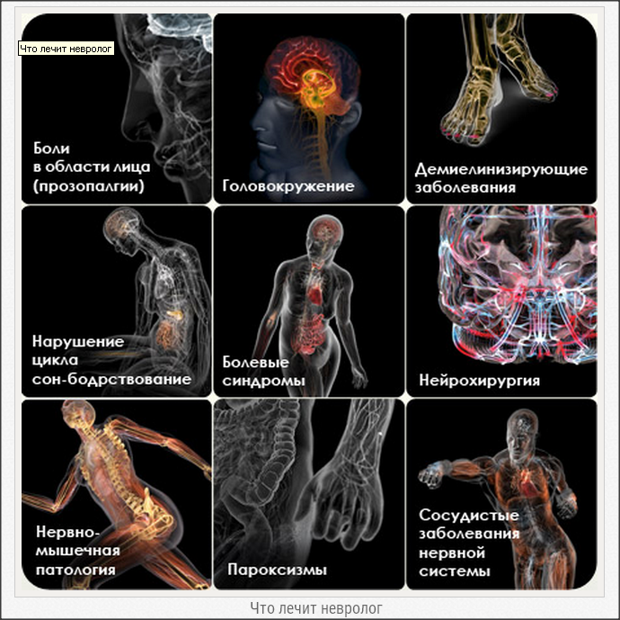 Патология боли. Заболевания нервной системы. Заболевания нервной системы неврология. Заболевания нервной системы симптомы. Симптомы и синдромы нервных болезней.