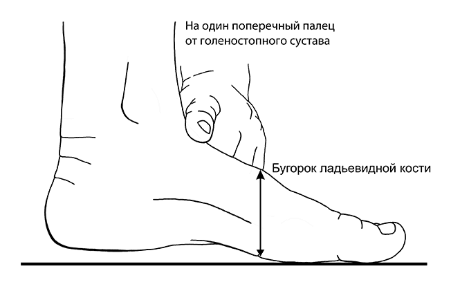 Болит подъем. Болит нога в подъеме стопы. Болит нога в верхней части стопы.