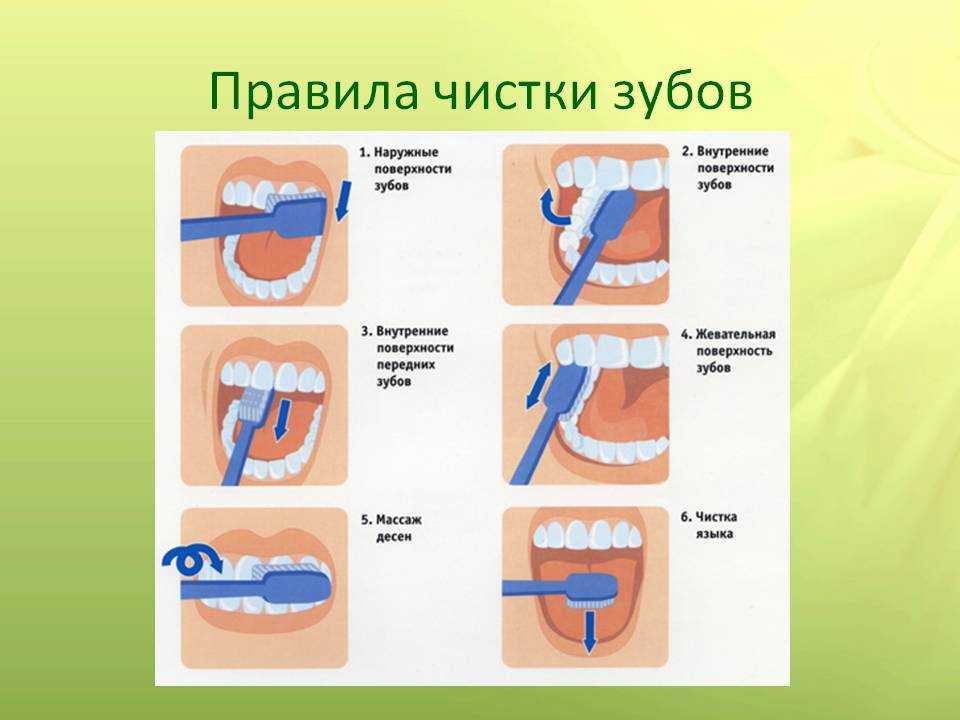 Последовательность очищения. Техника чистки зубов. Как правильно чистить зубы детям. Правила чистки зубов для детей. Как правильно чистить зубы картинки для детей.