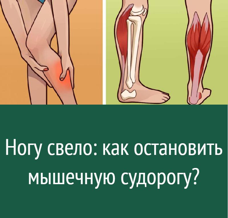 Ногу свело сильно болит. Судорога икроножной мышцы. Мышечные спазмы в ногах. Судороги нижних конечностей.