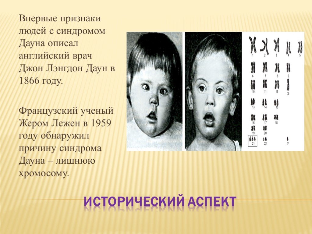 Что вызывает болезнь дауна. Джон Лэнгдон синдром Дауна хромосомы. Наследственные болезни человека синдром Дауна. Синдром Дауна это наследственное заболевание. Синдром Дауна презентация.