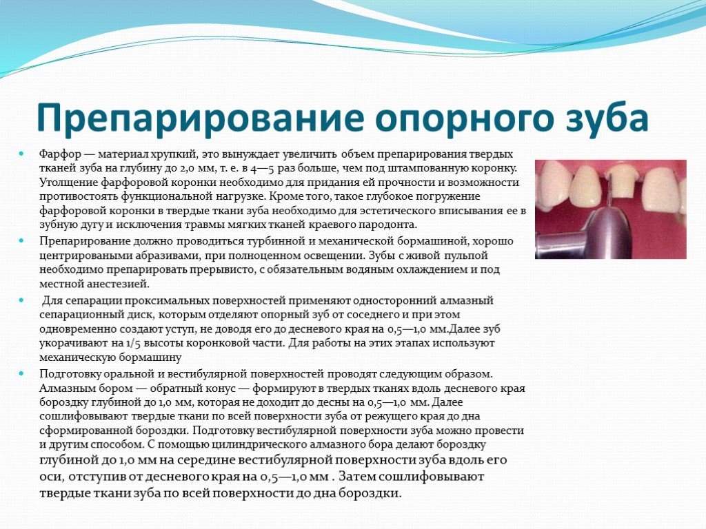 Ортопедический этап лечения. Препарирование твердых тканей зуба. Методы препарирования зубов. Методы препарирования твердых тканей.