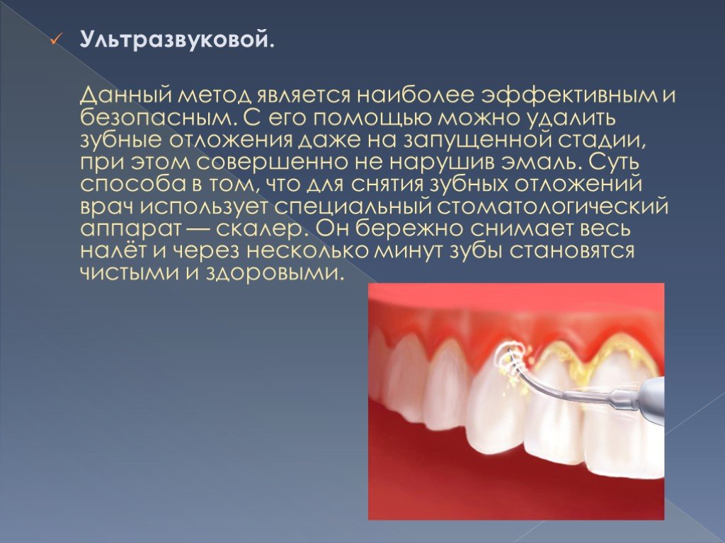 Ультразвук в стоматологии презентация